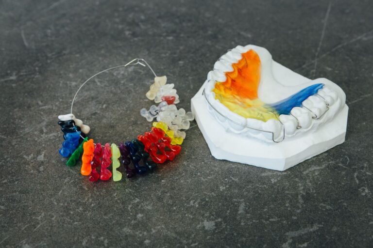 Zahnabdruck für eine Zahnspange mit verschiedenen Farbmuster-Beispielen zur Auswahl.