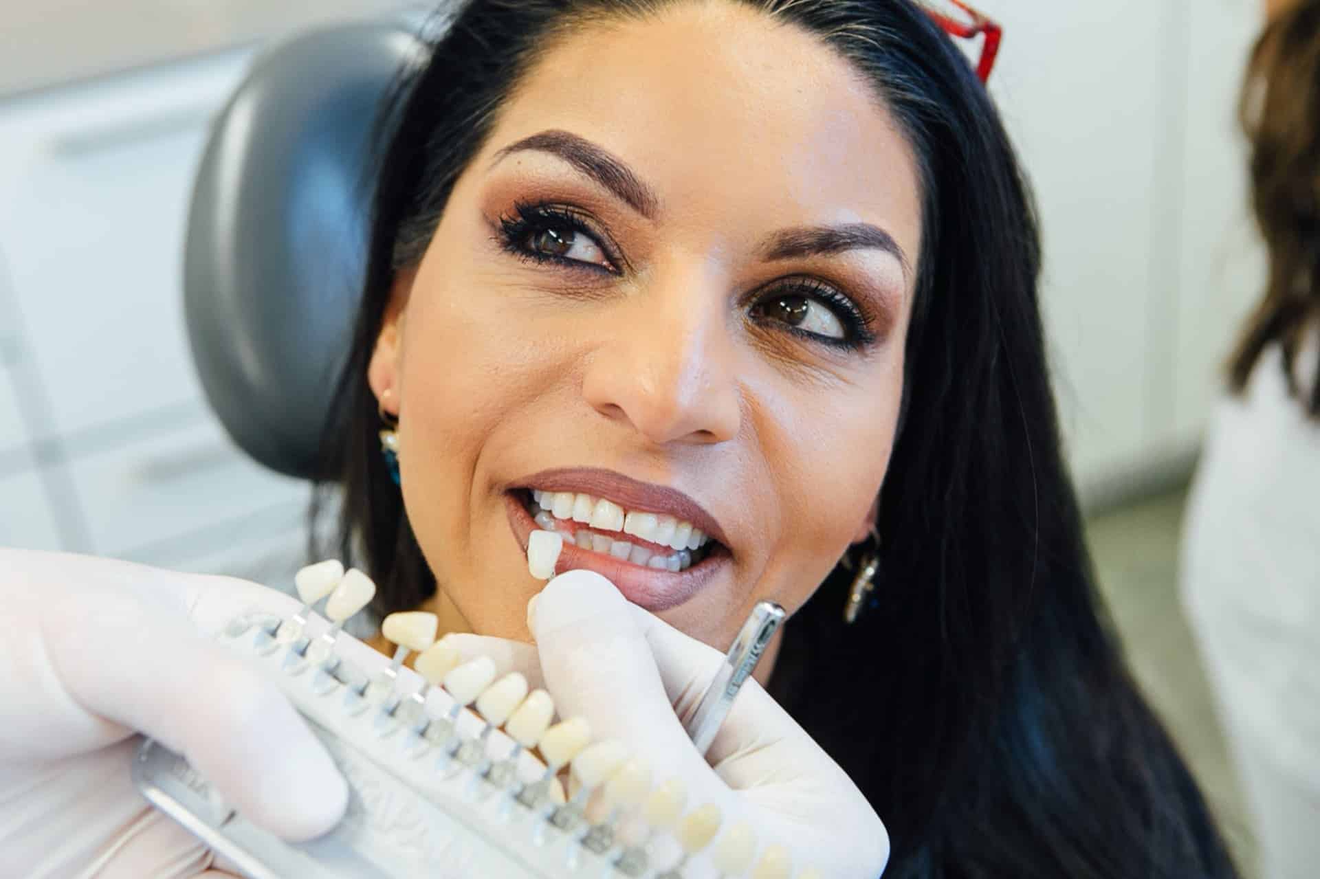 Abgleich der Zahnfarbe bei einer Patientin mit Hilfe von Zahnfarbmustern.